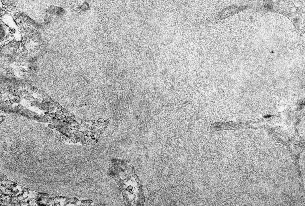 Electron microscopy 2